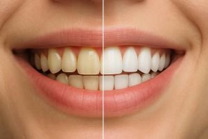 teeth