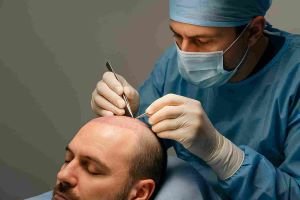 hair transplant